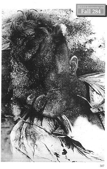160 German soldiers fell into the hands of the Russian Army